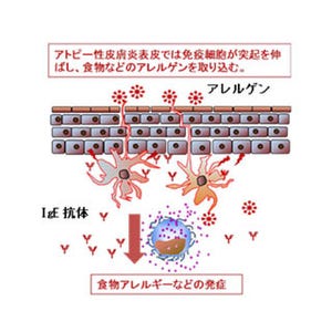 乳児に保湿剤を塗ることでアトピー性皮膚炎の発症率が3割低下 - NCCHD