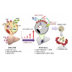 メタボを抑制するタンパク質に肝臓がんを除去する働き - 東大が確認