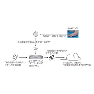 京大、関節リウマチの原因となる自己抗原を同定