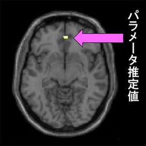 自閉症スペクトラム症の人は同じ症状の人に共感する - 京大が確認