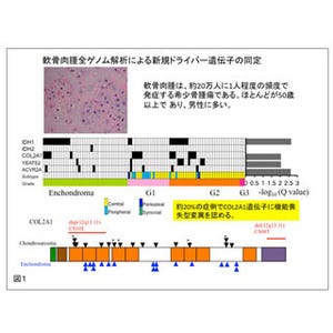 国立がん研、軟骨肉腫の全ゲノムを解読し新たなゲノム異常を同定