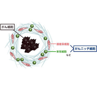 がんの転移抑える既存薬を発見