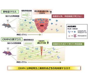 脊髄損傷の治療標的タンパク質を特定