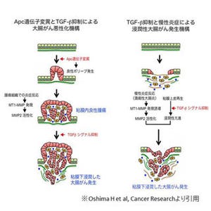 慢性炎症を抑えることでがんの悪性化を制御できる可能性 - 金沢大