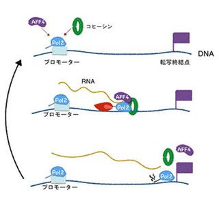 新しい遺伝病発見、原因の仕組みも解明