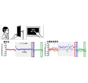 小脳の運動学習の定量的測定法を開発