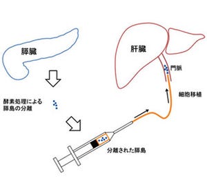 膵島移植に有用な酵素カクテルを開発