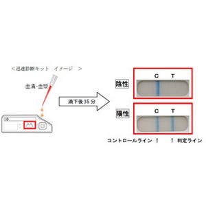 北大とデンカ生研、エボラウイルス感染の有無を15分で判定する診断薬を開発