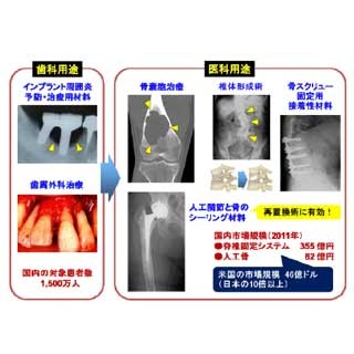 北大など、多目的人工骨を開発するベンチャー企業を設立