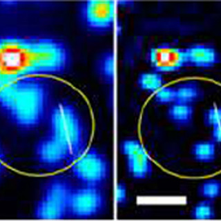 オリンパス、生きた細胞内の微細構造の観察を可能にする顕微鏡技術を開発