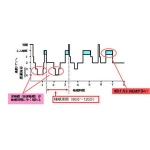 睡眠障害の改善が糖尿病の血糖改善などに有効であることを確認 - 大阪市立大