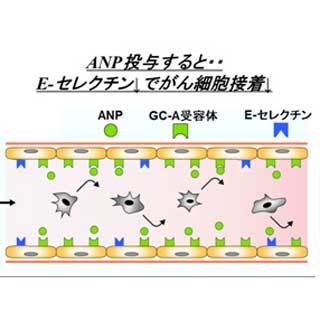 心臓ホルモンのがん転移抑制効果、世界で初の臨床研究実施へ - 国循