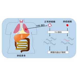 ATR、心臓ホルモンの肺がん転移抑制効果に関する研究で国循と共同研究