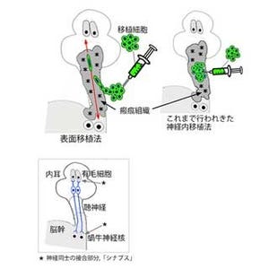 従来の考え方を覆す新たな細胞移植法で聴神経の再生に成功 - 京大