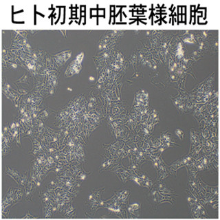 京大、ヒトiPS細胞から卵子や精子の前駆細胞を効率よく誘導する方法を開発