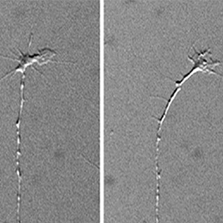 理研、脂質が異なる種類の感覚を脊髄で分けていることを発見