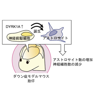 東大、ダウン症で脳細胞の発生異常が起きる仕組みを解明