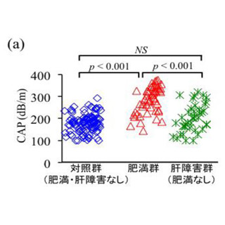 肥満小児は脂肪肝の頻度が高く肝硬変のリスクも高い - 大阪市大が調査