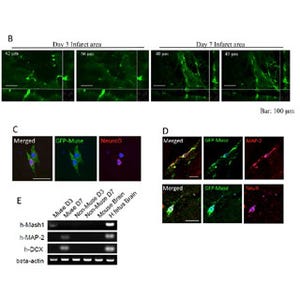 脳梗塞で失われた機能を細胞移植によって回復 - 東北大学がラットで成功