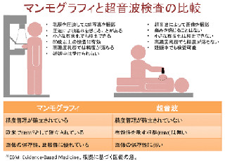 マンモグラフィ＋超音波で乳がんの早期発見率が約1.5倍に - 東北大