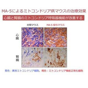 東北大、腎臓病患者の血液からミトコンドリア病の進行を抑える化合物を開発