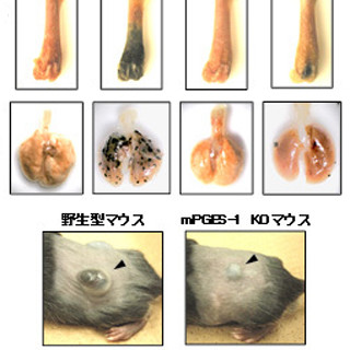 がん転移には炎症の原因物質「プロスタグランジンE」が関与 - 農工大