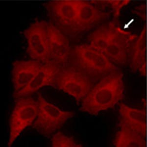 理研、がん細胞の転移を抑える新たな仕組みを発見