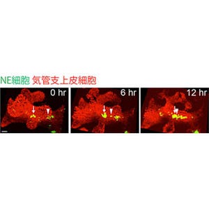 理研、小細胞肺がんの起源となる細胞が塊を作る様子の撮影に成功