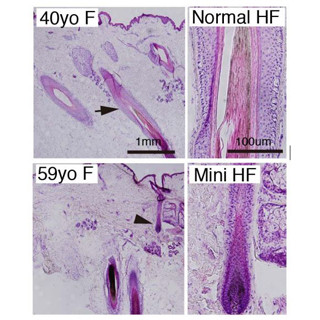 加齢によって髪の毛が薄くなる仕組みが明らかに - 東京医科歯科大が発表