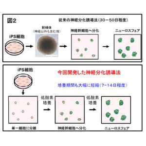 順天堂大と慶大、新誘導技術によりパーキンソン病iPS細胞バンクを構築へ