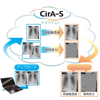 東陽テクニカ、胸部X線骨組織透過処理および経時差分処理をクラウドで提供