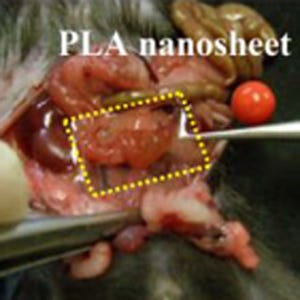 防衛医大と早大、「ナノ絆創膏」に腸の癒着を防ぐ働きがあることを発見