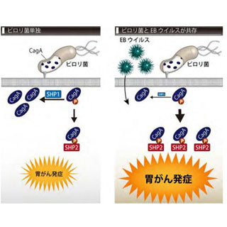 ピロリ菌とウイルスの連携により胃がん発症抑えるSHP1の発現が抑制 - 東大