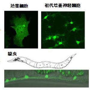 産総研、アルツハイマー病の原因タンパク質を細胞内で可視化することに成功