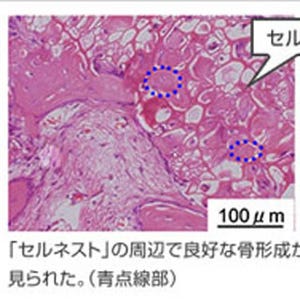 富士フイルム、骨欠損部への人工タンパク質移植で骨再生能力を大幅に向上