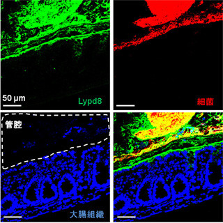 阪大、腸内細菌の大腸組織侵入を防いで腸管炎症を抑えるメカニズムを解明