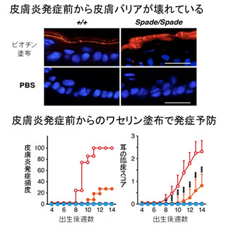 ワセリン塗布にアトピー性皮膚炎の発症予防効果 - 理研がマウスで確認