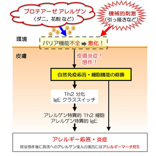 アレルゲンに触れた状態で皮膚を掻くとアレルギーは重症化する - 順天堂大