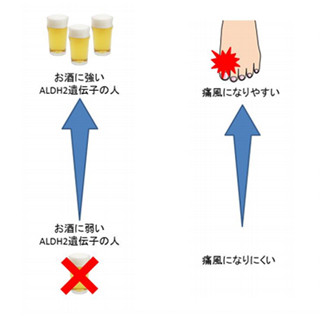 お酒に強い遺伝子持つ人は痛風リスク2倍以上