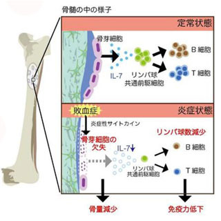 敗血症後の免疫力低下は、骨をつくる骨芽細胞の障害が原因 - 東大