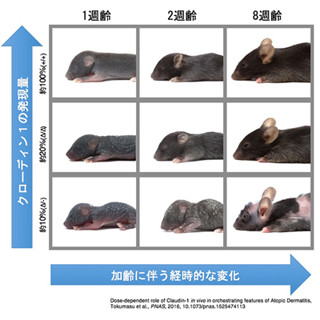 クローディン1遺伝子の発現量によってアトピー性皮膚炎の症状が変化 - 阪大