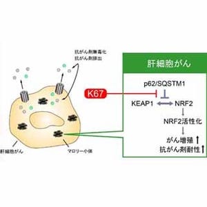 肝臓がんを抑制し抗がん剤の効果を高める新規化合物を同定 - 新潟大など