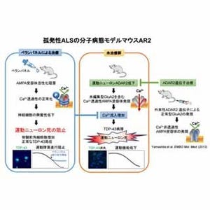 東大、既存の抗てんかん薬を用いたALSの新規治療法 - マウスで有効性確認