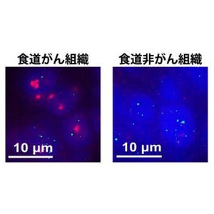 遺伝研、ヒトがん病理標本のテロメア短縮を短時間で検出することに成功