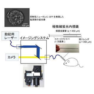 東北大、低侵襲で脳の神経活動を可視化するイメージングシステムを商品化