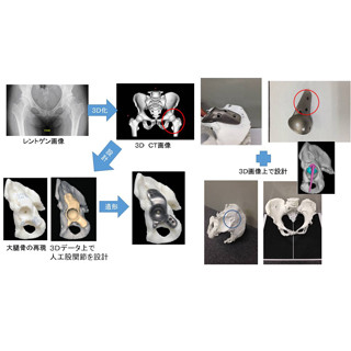 J・3Dと名古屋市立大、金属3Dプリンタによるカスタム人工関節を開発へ