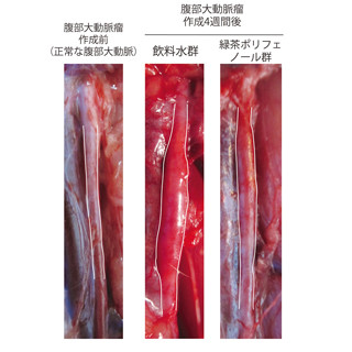 緑茶ポリフェノールの摂取が腹部大動脈瘤の増大を予防 - 京大が発表