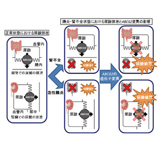 尿酸値は小腸障害のマーカーになる 防衛医大などが発見