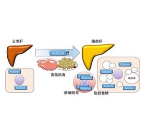 脂肪肝を悪化させるタンパク質判明 大阪大グループ