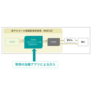 東大とキュア・アップ、非アルコール性脂肪肝専用治療アプリの臨床研究開始